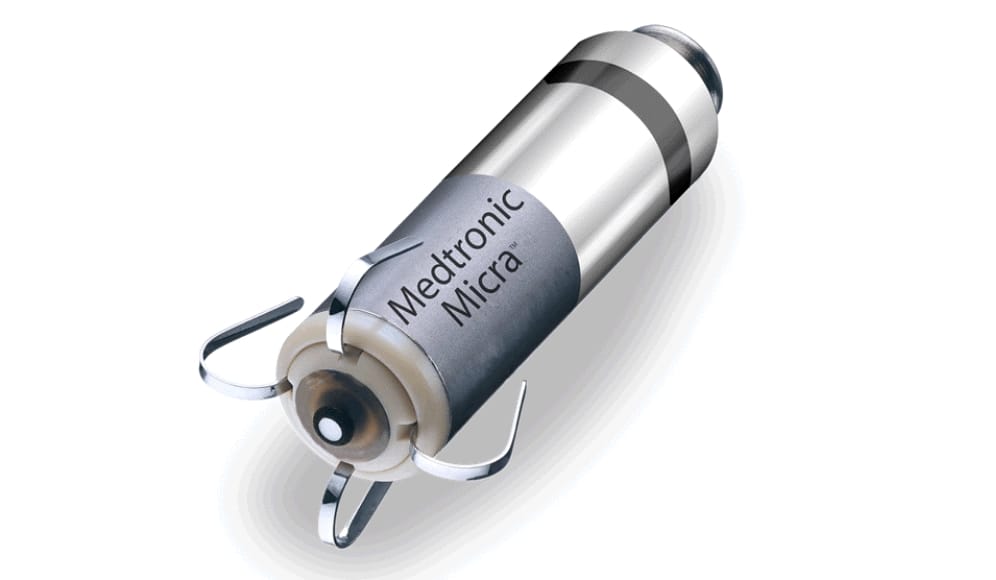 リードレスペースメーカ手術02