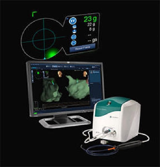 高周波通電によるアブレーション機器