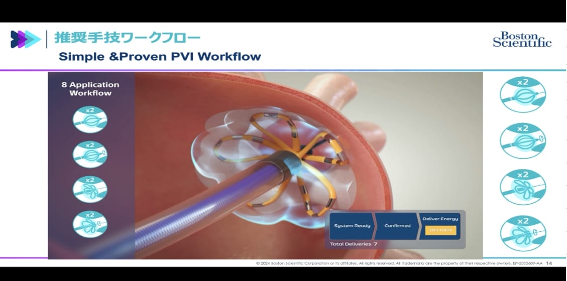 パルスフィールドアブレーションシステム治療イメージ02