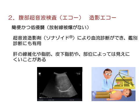 腹部超音波検査（エコー）造影エコー